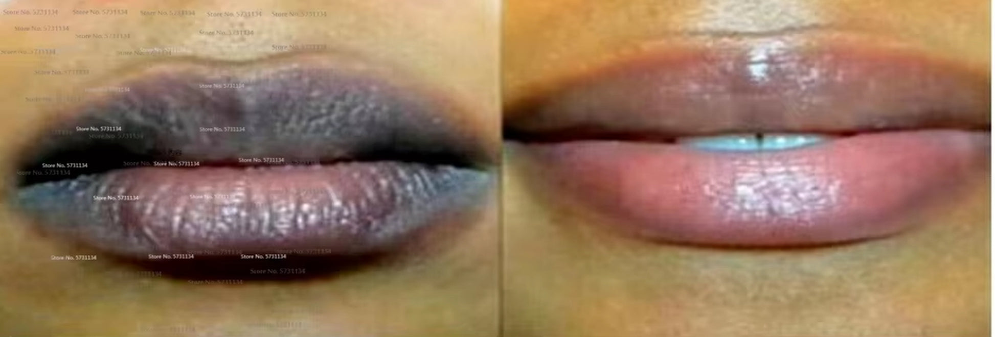 Lip Care of Lips Pink Fresh Lightening Bleaching Cream Treatment Remove Dark Smoke Lips Lip Oil